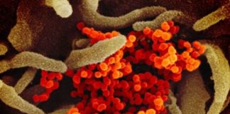 Algernon Pharma appoints Novotech to begin phase 2 trial of Ifenprodil to treat coronavirus Algernon Pharma