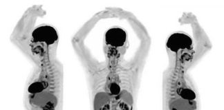 Explorer – Total-body imaging scanner captures 3D picture in seconds Explorer