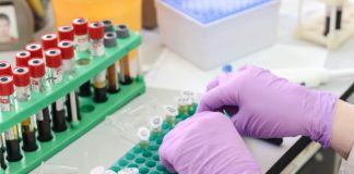 Lilly initiates phase 1 study for second potential Covid-19 antibody treatment vaccine