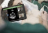 Philips receives FDA clearance for using its ultrasound solution to manage COVID-19-related complications Philips