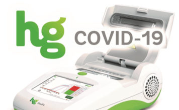 Queen’s University receives funding to conduct COVID-19 rapid testing trial Queen's University