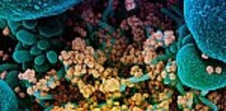 NIH halts clinical trial of hydroxychloroquine hydroxychloroquine