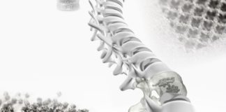 MT Ortho’s additive technology to manufacture customized prostheses MT Ortho