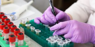 CCMB researchers develop low-cost novel coronavirus test CCMB