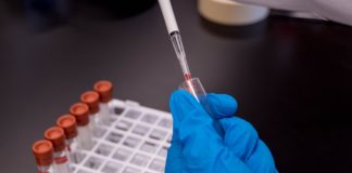 CEPI, UQ and CSL partner for development and manufacture of Covid-19 vaccine candidate CEPI