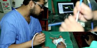 Device for non-invasive screening of bilirubin level in newborns screening