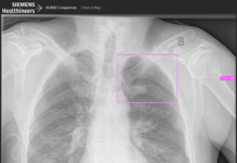 Siemens expands AI portfolio in the field of clinical decision-making AI