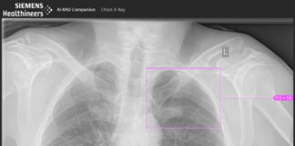 Siemens expands AI portfolio in the field of clinical decision-making AI