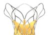 SMT launches TAVR device hydra in central Europe SMT
