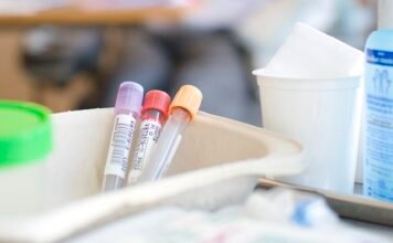 Roche to launch SARS-CoV-2 Rapid Antigen Test in countries accepting CE mark Roche