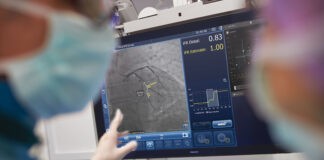 Define PCI study data show potential of treating residual ischemia Define PCI