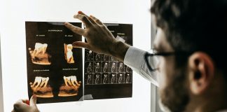 Army Hospital uses 3D printing for maxillofacial surgery 3D printing