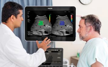 Philips advances ultrasound portfolio Philips
