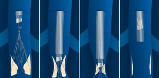 Philips receives FDA De Novo Clearance for IVC filter removal laser sheath Philips received FDA De Novo Clearance for CavaClear, an IVC filter removal laser sheath