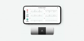 Voluntis and AliveCor partners to help patients with cancer Voluntis