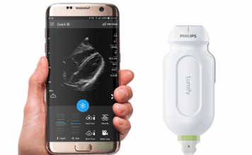 Philips expands access to hemodynamics Philips
