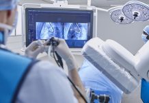 Philips launches new 3D facilities to treat lung cancer Philips lung suite for diagnosis and treating cancer at an early stage Photo: Philips