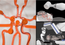 Joystick-Operated robot to help surgeons treat stroke remotely