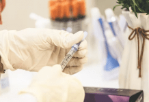 Spike in vascular necrosis cases in Covid patients vascular