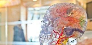 Brain stroke increasing in young population Brain Stroke