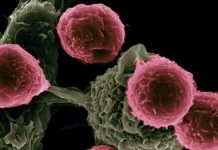 India can take a big leap in cancer care Experts See India’s Daycare Cancer Centers in Alignment with World Cancer Day’s 'United by Unique' Campaign