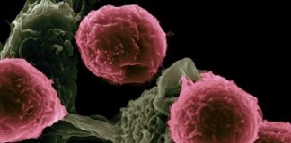 Epigenetic approach to combat graft-versus-host disease Experts See India’s Daycare Cancer Centers in Alignment with World Cancer Day’s 'United by Unique' Campaign