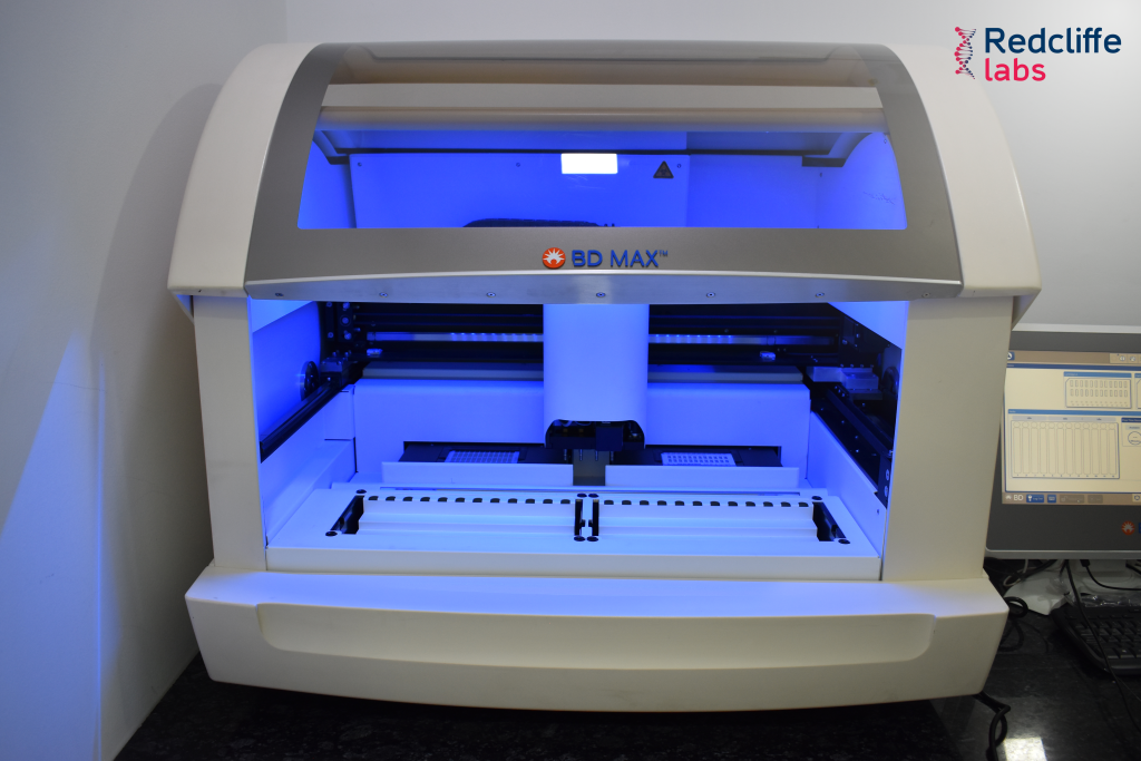 Redcliffe Labs launches single test for multidrugresistant TB