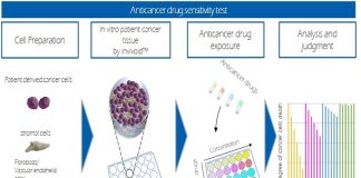 Anticancer drugs research by Osaka University, JFCR and Toppan Anticancer