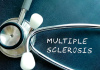 Artificial intelligence models predict multiple sclerosis artificial