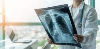 Centre recommends reporting Influenza as covid cases rise influenza