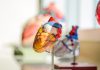 Carmat announces first implant of Aeson artificial heart Carmat
