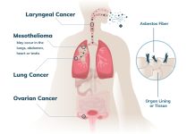 Queen Mary University London develops a new ‘wonder’ drug for cancer drug