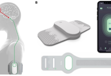 Drug-free migraine treatment from Dr Reddy’s, betapharm & Theranica drug
