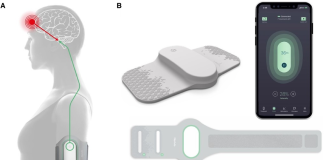 Drug-free migraine treatment from Dr Reddy’s, betapharm & Theranica drug