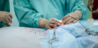 AI analytics for hip and knee orthopedic surgery costs knee