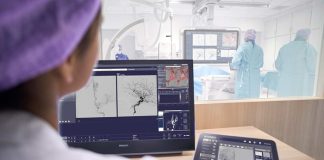 World Stroke Organization and Philips to improve stroke care Philips