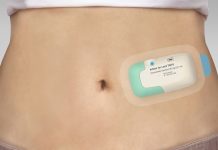 FDA grants tentative approval of SQ Innovation’s Lasix ONYU FDA