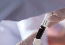 Simple test could better predict your risk of heart disease disease