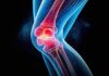 Globally proven medial-pivot knee implant technology now in Bengaluru medical