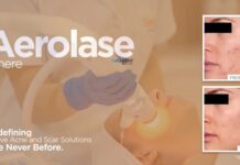 Kaya launches Aerolase Neo Elite Kaya