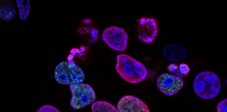 India’s new hope against sickle cell sickle cell