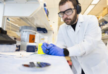 At-home melanoma testing with skin patch test melanoma