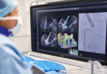 Heart valve repair – Philips brings AI into procedure room Philips
