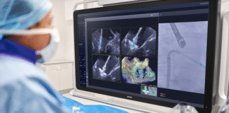 Heart valve repair – Philips brings AI into procedure room Philips