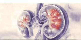 Aakash Healthcare marks 100 robotic urology surgeries Aakash