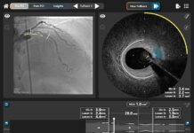 Philips agrees to acquire SpectraWAVE Inc Philips