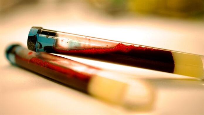 unnamed Parkinson’s