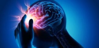 Epilepsy—Doctors highlight need for awareness, breaking myths Epilepsy