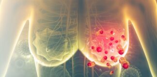 Standard radiotherapy treatment for breast cancer set to change  Breast