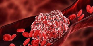 Rare hidden blood disorder treated blood